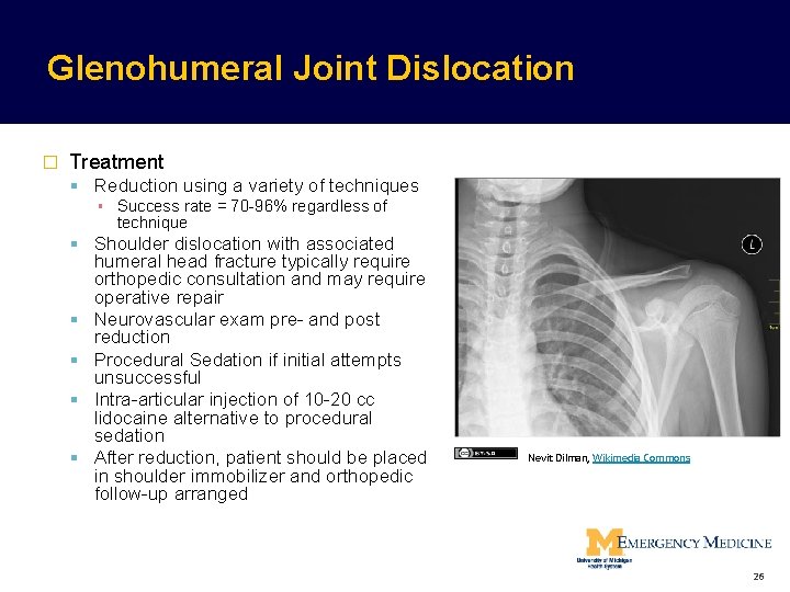 Glenohumeral Joint Dislocation � Treatment Reduction using a variety of techniques ▪ Success rate Glenohumeral Joint Dislocation � Treatment Reduction using a variety of techniques ▪ Success rate