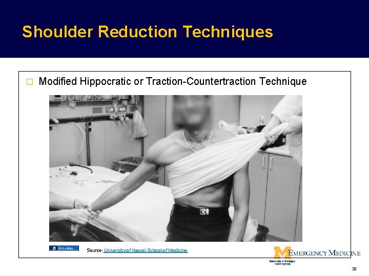 Shoulder Reduction Techniques � Modified Hippocratic or Traction-Countertraction Technique Source: University of Hawaii School Shoulder Reduction Techniques � Modified Hippocratic or Traction-Countertraction Technique Source: University of Hawaii School
