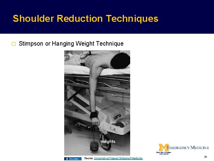 Shoulder Reduction Techniques � Stimpson or Hanging Weight Technique Source: University of Hawaii School Shoulder Reduction Techniques � Stimpson or Hanging Weight Technique Source: University of Hawaii School