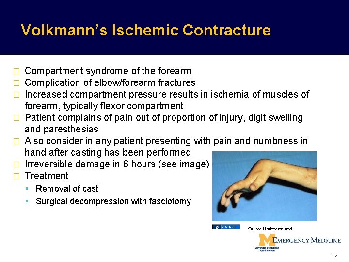 Volkmann’s Ischemic Contracture � � � � Compartment syndrome of the forearm Complication of Volkmann’s Ischemic Contracture � � � � Compartment syndrome of the forearm Complication of