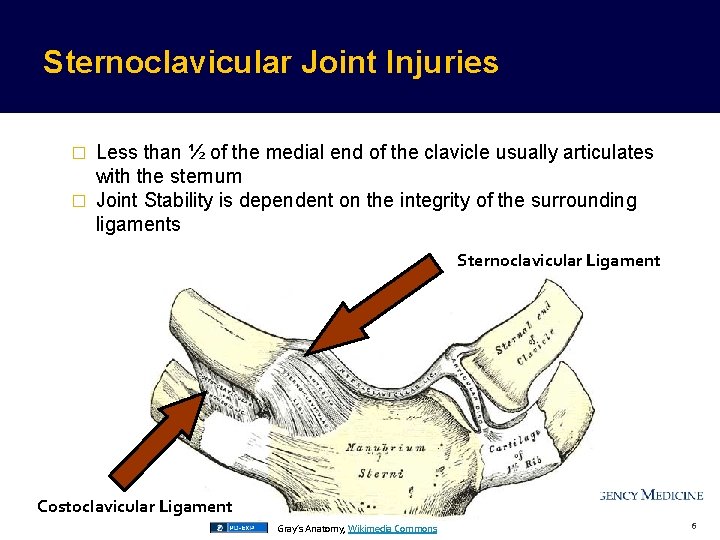 Sternoclavicular Joint Injuries Less than ½ of the medial end of the clavicle usually Sternoclavicular Joint Injuries Less than ½ of the medial end of the clavicle usually