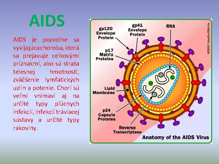 AIDS je pozvoľne sa vyvíjajúca choroba, ktorá sa prejavuje celkovými príznakmi, ako sú strata