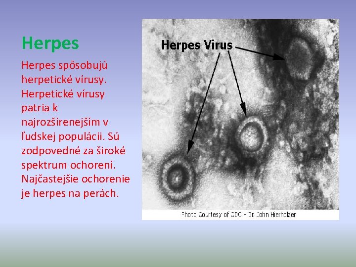 Herpes spôsobujú herpetické vírusy. Herpetické vírusy patria k najrozšírenejším v ľudskej populácii. Sú zodpovedné