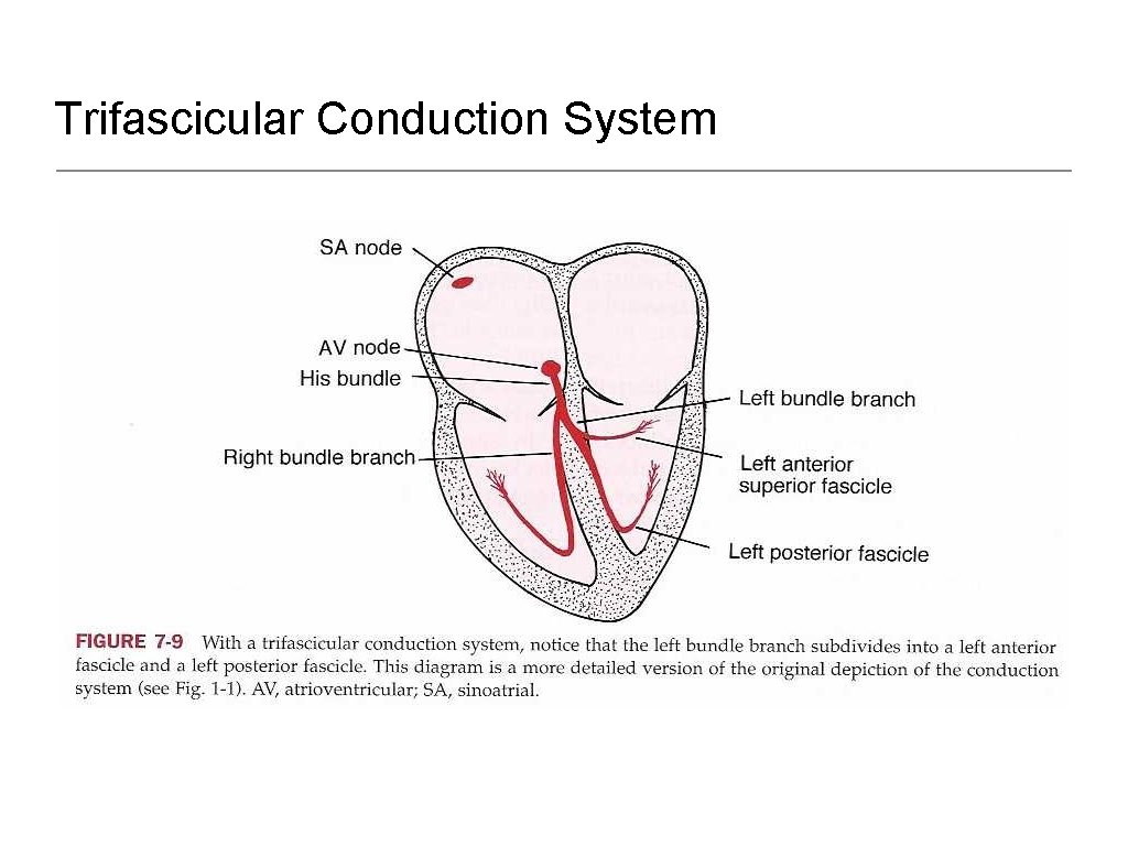 Trifascicular Conduction System 