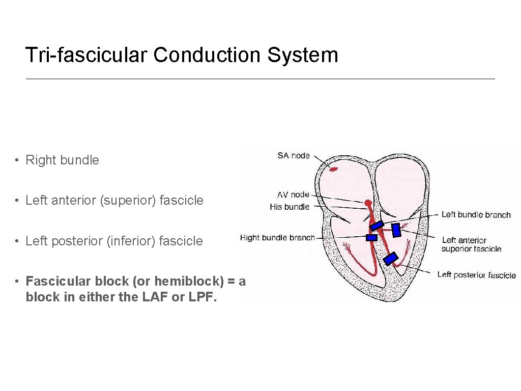 Tri-fascicular Conduction System • Right bundle • Left anterior (superior) fascicle • Left posterior