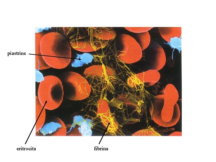 piastrine eritrocita fibrina 
