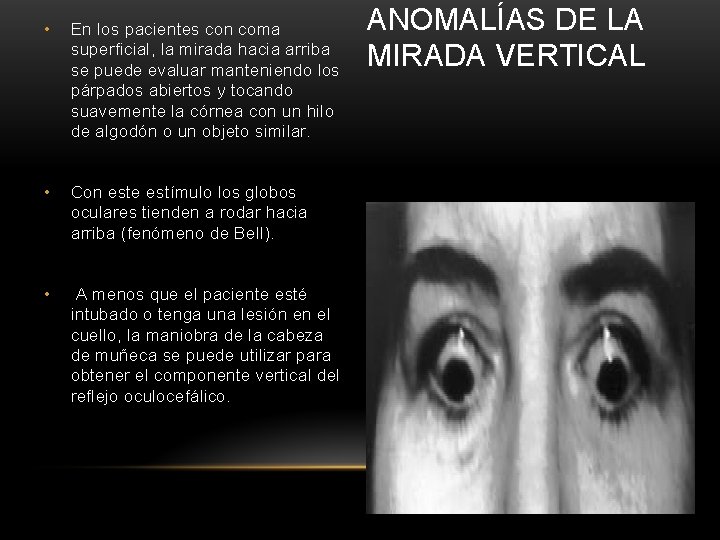  • En los pacientes con coma superficial, la mirada hacia arriba se puede
