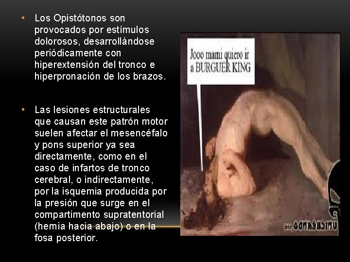  • Los Opistótonos son provocados por estímulos dolorosos, desarrollándose periódicamente con hiperextensión del