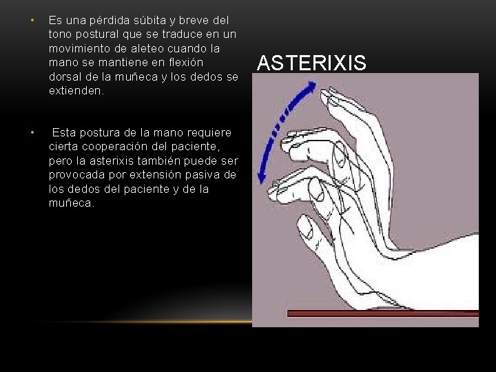  • • Es una pérdida súbita y breve del tono postural que se