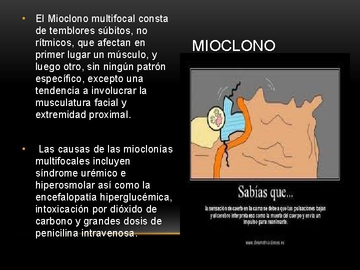  • El Mioclono multifocal consta de temblores súbitos, no rítmicos, que afectan en