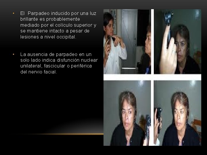  • El Parpadeo inducido por una luz brillante es probablemente mediado por el
