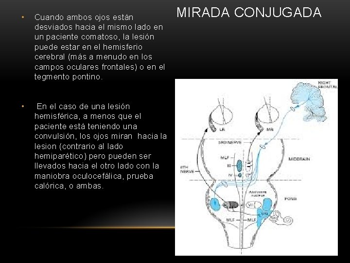  • Cuando ambos ojos están desviados hacia el mismo lado en un paciente