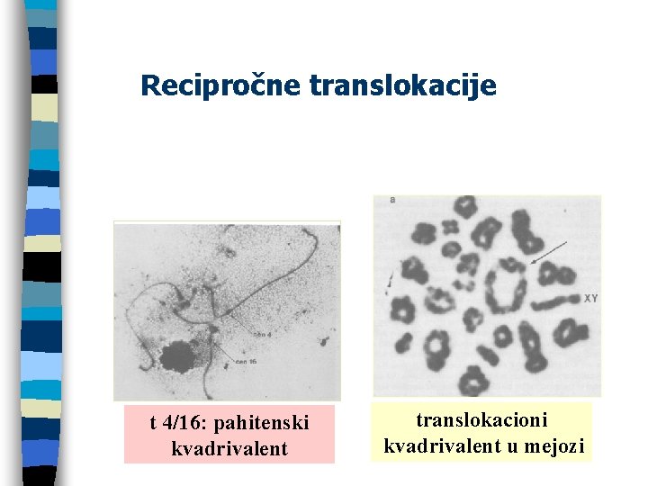 Recipročne translokacije t 4/16: pahitenski kvadrivalent translokacioni kvadrivalent u mejozi 