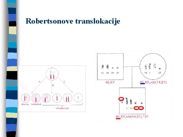 Robertsonove translokacije 