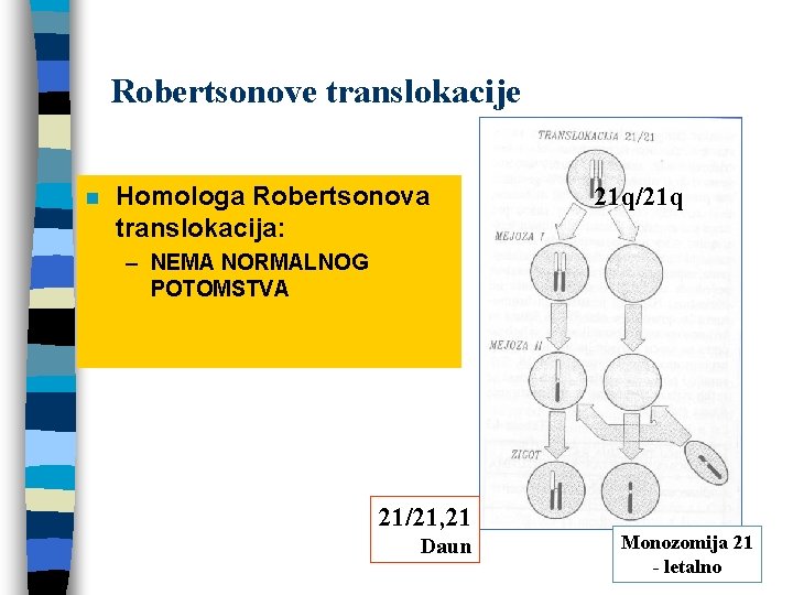 Robertsonove translokacije n Homologa Robertsonova translokacija: 21 q/21 q – NEMA NORMALNOG POTOMSTVA 21/21,