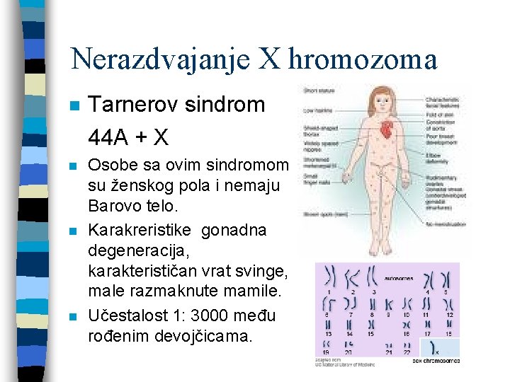 Nerazdvajanje X hromozoma n Tarnerov sindrom 44 A + X n Osobe sa ovim