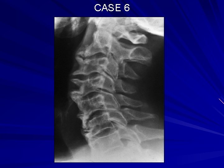 CASE 6 