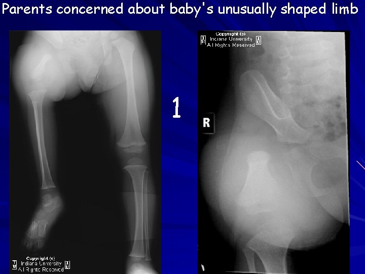 Parents concerned about baby's unusually shaped limb 1 