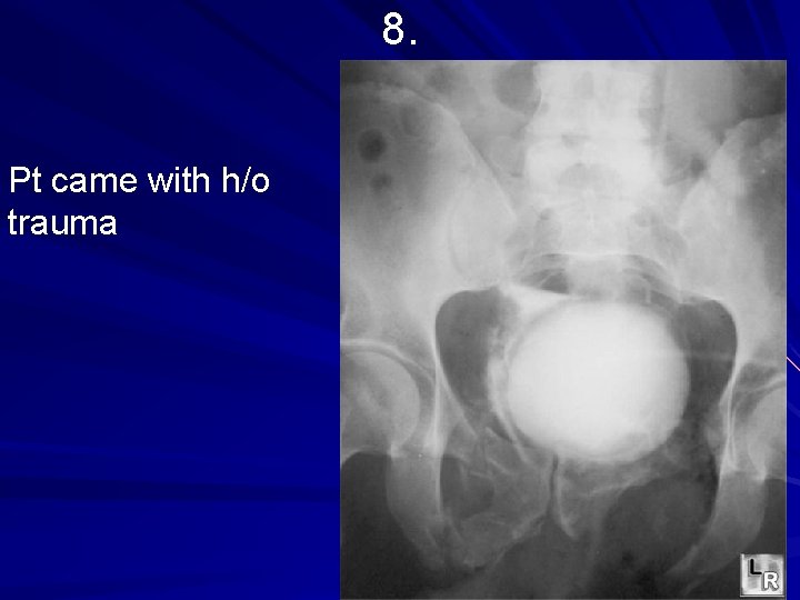 8. Pt came with h/o trauma 