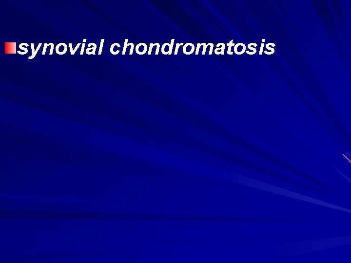 synovial chondromatosis 