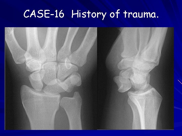 CASE-16 History of trauma. 