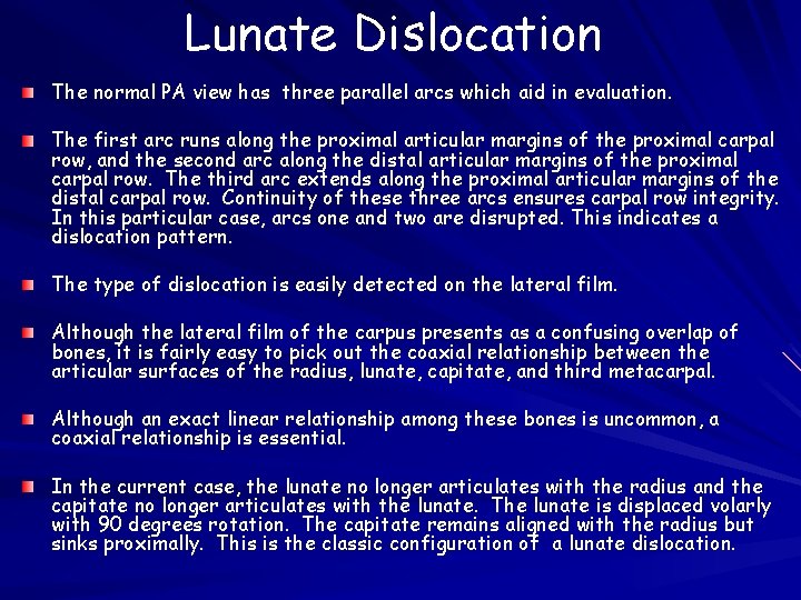 Lunate Dislocation The normal PA view has three parallel arcs which aid in evaluation.