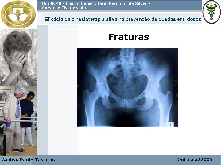 Uni IBMR - Centro Universitário Hermínio da Silveira Curso de Fisioterapia Eficácia da cinesioterapia