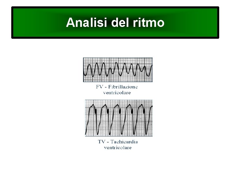 Analisi del ritmo 