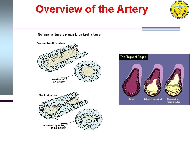 Overview of the Artery 