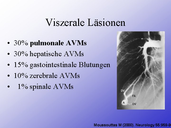 Viszerale Läsionen • • • 30% pulmonale AVMs 30% hepatische AVMs 15% gastointestinale Blutungen