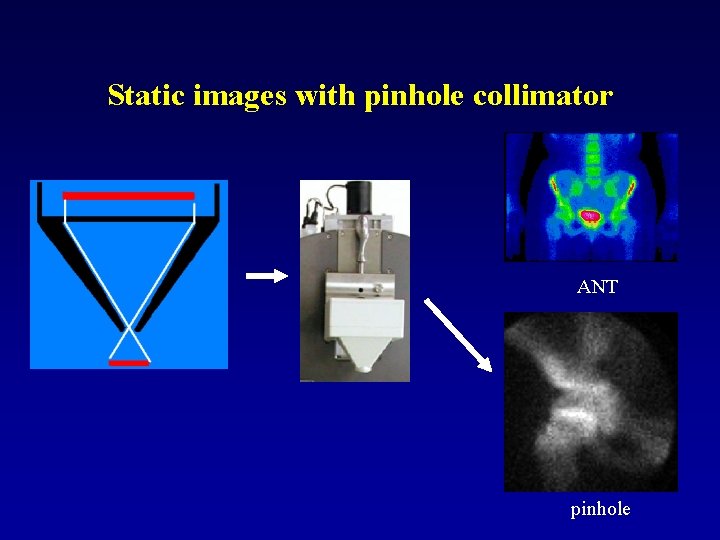 Static images with pinhole collimator ANT pinhole 