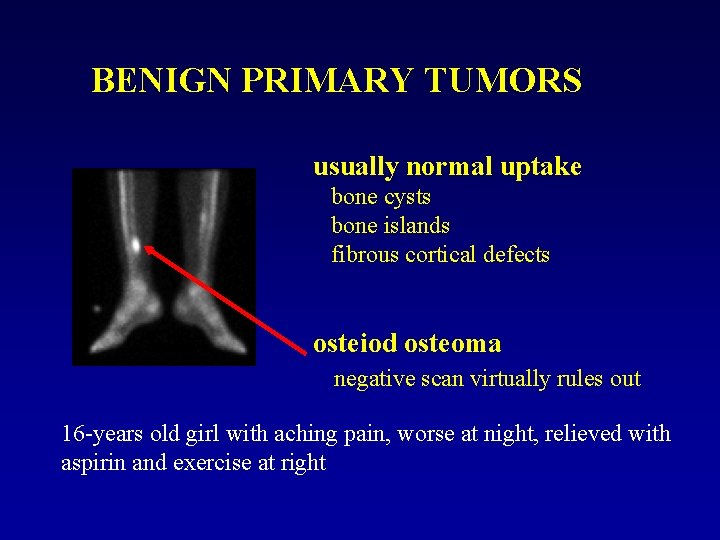 BENIGN PRIMARY TUMORS usually normal uptake bone cysts bone islands fibrous cortical defects osteiod