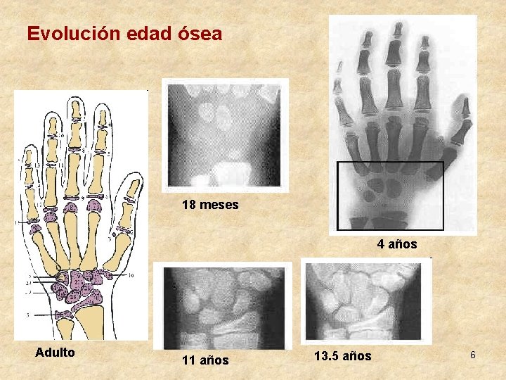 Evolución edad ósea 18 meses 4 años Adulto 11 años 13. 5 años 6
