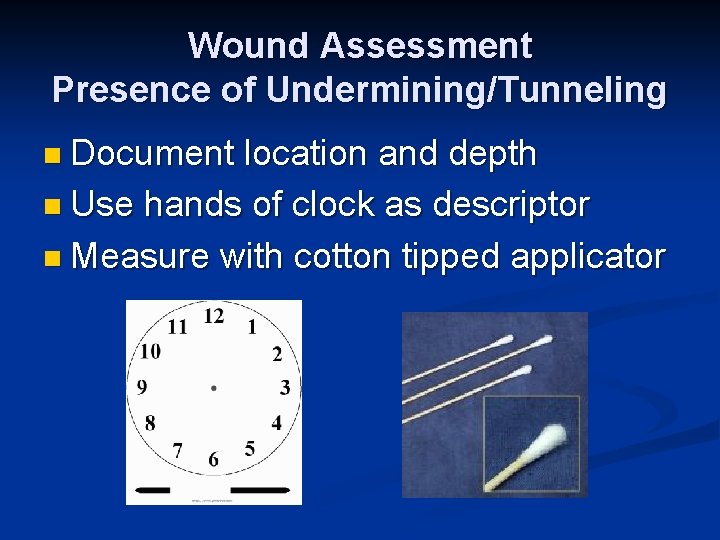 Wound Assessment Presence of Undermining/Tunneling n Document location and depth n Use hands of