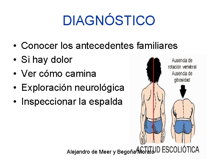 DIAGNÓSTICO • • • Conocer los antecedentes familiares Si hay dolor Ver cómo camina