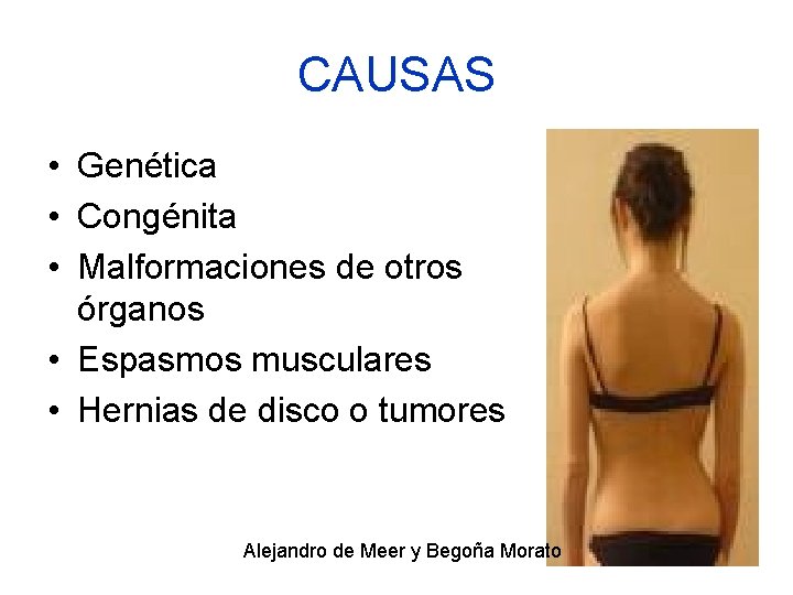 CAUSAS • Genética • Congénita • Malformaciones de otros órganos • Espasmos musculares •