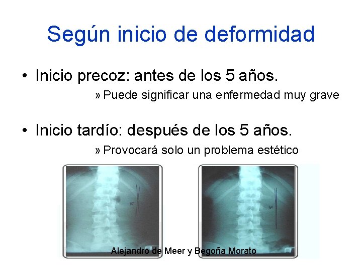 Según inicio de deformidad • Inicio precoz: antes de los 5 años. » Puede