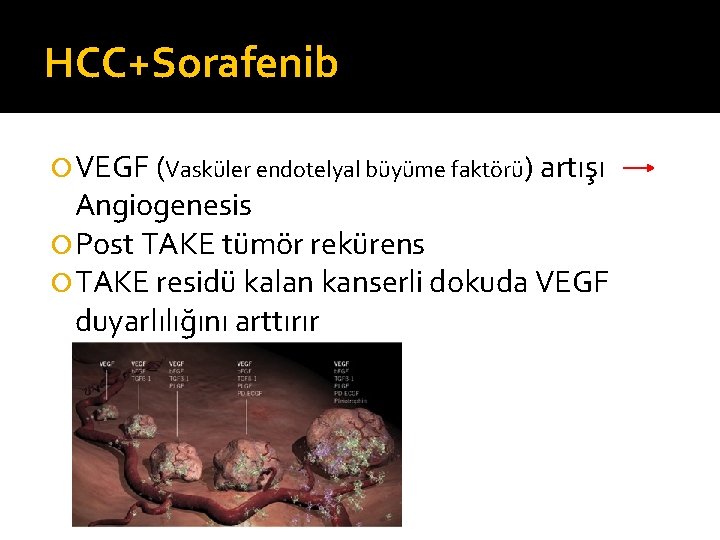 HCC+Sorafenib VEGF (Vasküler endotelyal büyüme faktörü) artışı Angiogenesis Post TAKE tümör rekürens TAKE residü