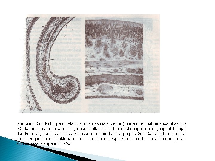 Gambar : Kiri : Potongan melalui Konka nasalis superior ( panah) terlihat mukosa olfaktoria