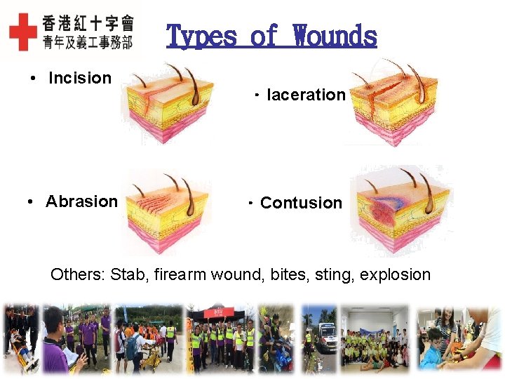 Types of Wounds • Incision • Abrasion • laceration • Contusion Others: Stab, firearm