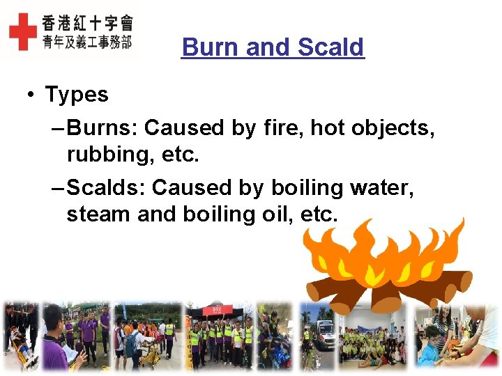 Burn and Scald • Types – Burns: Caused by fire, hot objects, rubbing, etc.