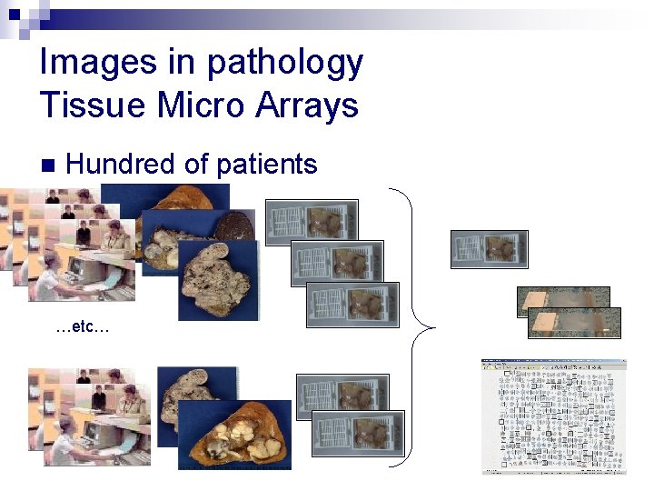 Images in pathology Tissue Micro Arrays n Hundred of patients …etc… 