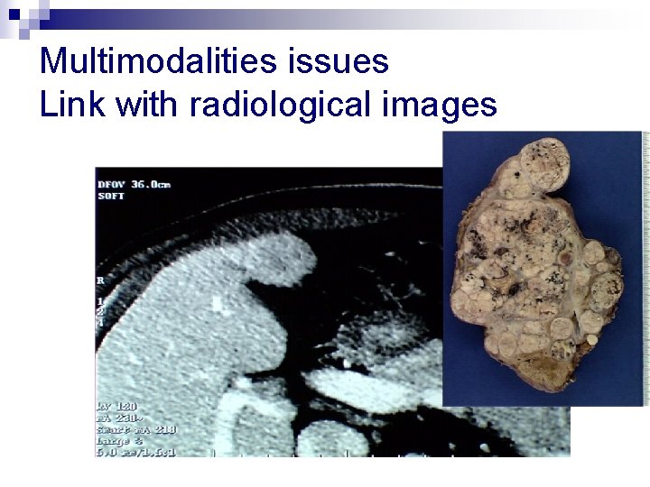 Multimodalities issues Link with radiological images 