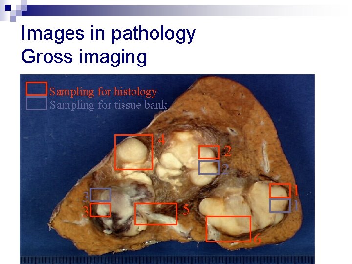 Images in pathology Gross imaging Sampling for histology Sampling for tissue bank 4 2