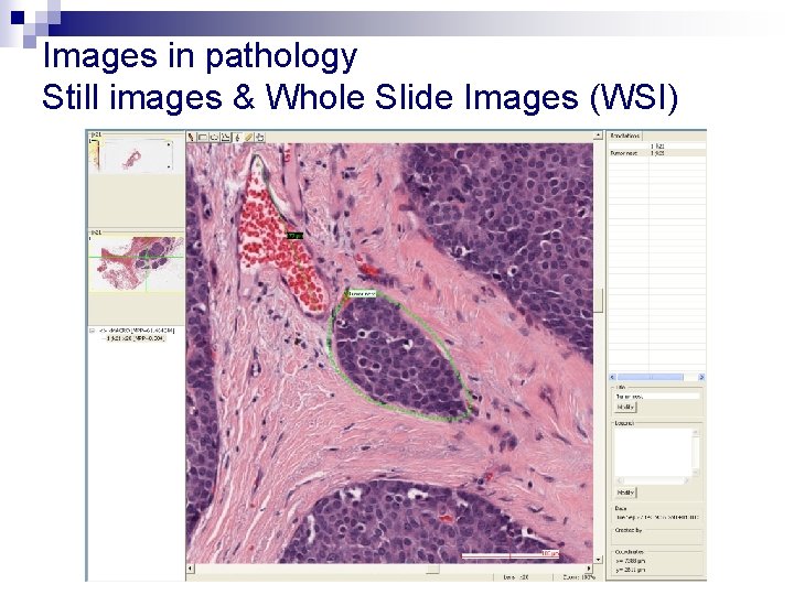 Images in pathology Still images & Whole Slide Images (WSI) 