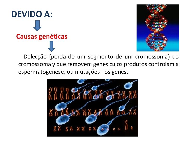 DEVIDO A: Causas genéticas Delecção (perda de um segmento de um cromossoma) do cromossoma