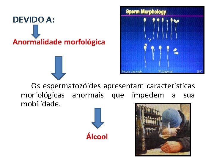 DEVIDO A: Anormalidade morfológica Os espermatozóides apresentam características morfológicas anormais que impedem a sua