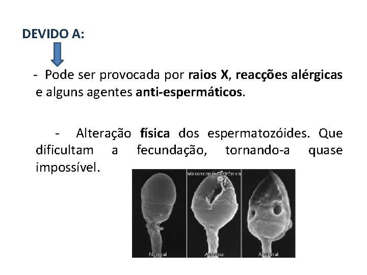 DEVIDO A: - Pode ser provocada por raios X, reacções alérgicas e alguns agentes