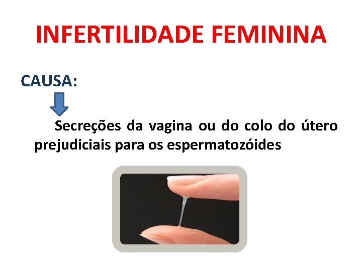 INFERTILIDADE FEMININA CAUSA: Secreções da vagina ou do colo do útero prejudiciais para os