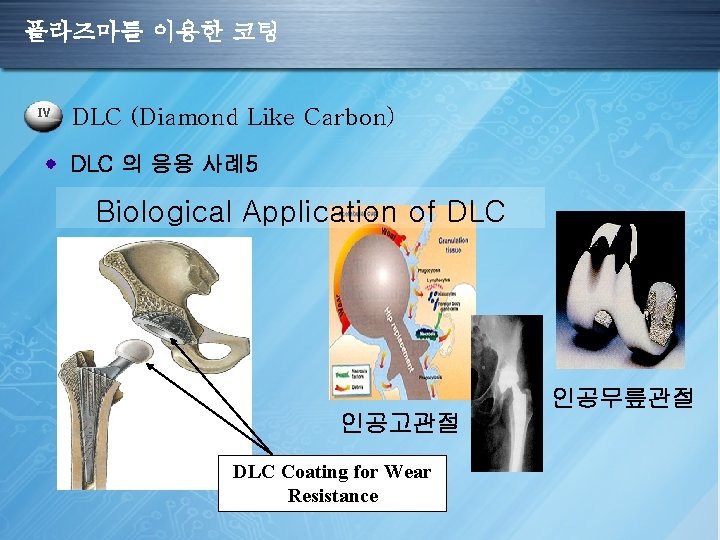 플라즈마를 이용한 코팅 IV DLC (Diamond Like Carbon) DLC 의 응용 사례5 Biological Application
